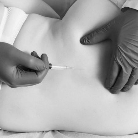 liecba_prp_plazmou_orthostabil_ortopedia_brigita_popovicova_presov01