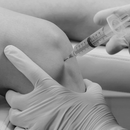 liecba_prp_plazmou_orthostabil_ortopedia_brigita_popovicova_presov02
